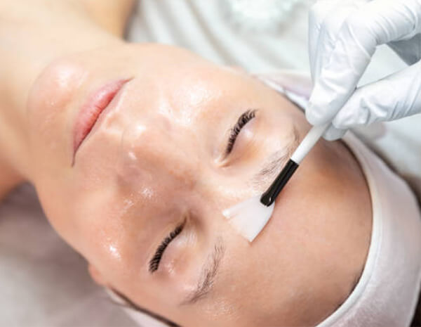 Facial Peels