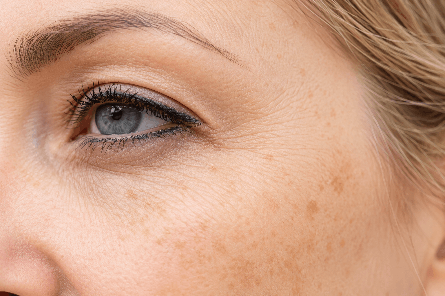 Skin pigmentation
